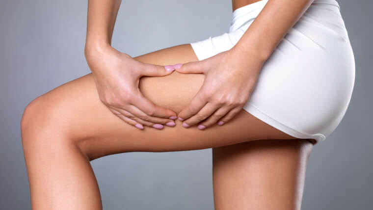 Stop à la cellulite